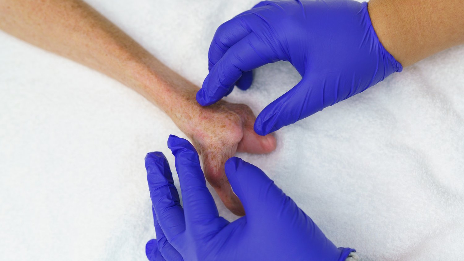 Occupational Therapy Arm Dynamics